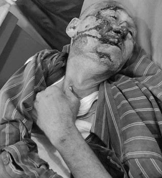 गम्भीर घाइते अवस्थामा भेटिएका पुरूषको मृत्यु, अझै भएन सनाखत