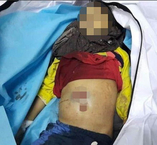 म्यानमारमा  ७ वर्षीया बालिकाको मृत्यु