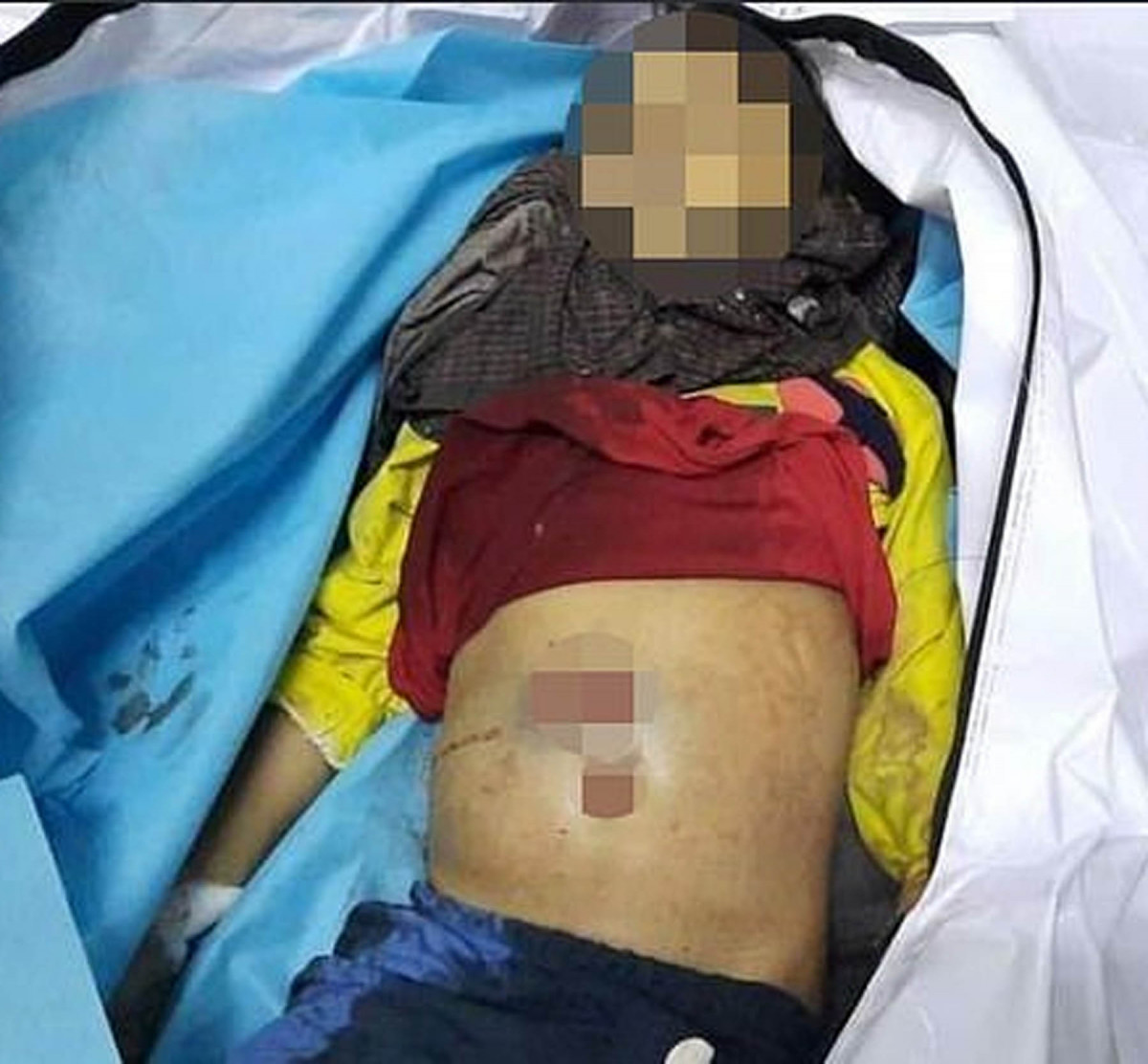 म्यानमारमा  ७ वर्षीया बालिकाको मृत्यु