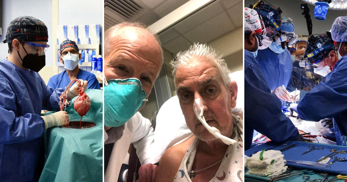 विश्वमै पहिलो पटक सुँगुरको मुटु प्रत्यारोपण गराएका बिरामीको २ महिनापछि मृत्यु