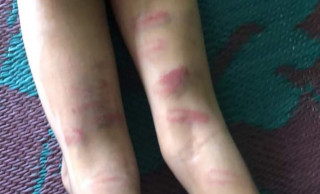 गृहकार्य नगरेको भन्दै शिक्षिकाद्धारा विद्यार्थीमाथि निर्घात कुटपिट