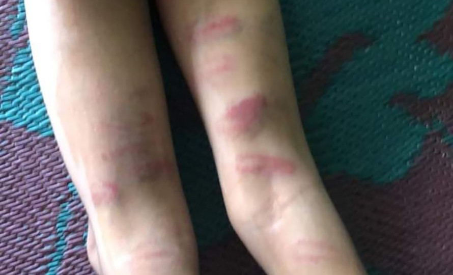 गृहकार्य नगरेको भन्दै शिक्षिकाद्धारा विद्यार्थीमाथि निर्घात कुटपिट