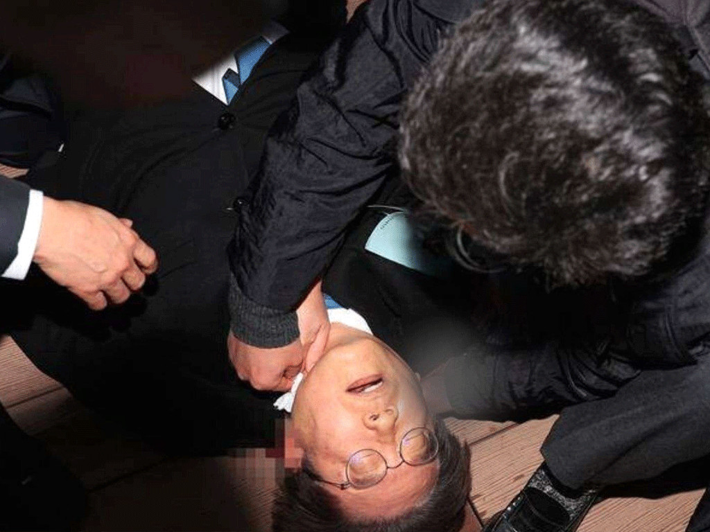 दक्षिण कोरियामा विपक्षी दलका नेता म्युङमाथि चक्कु प्रहार