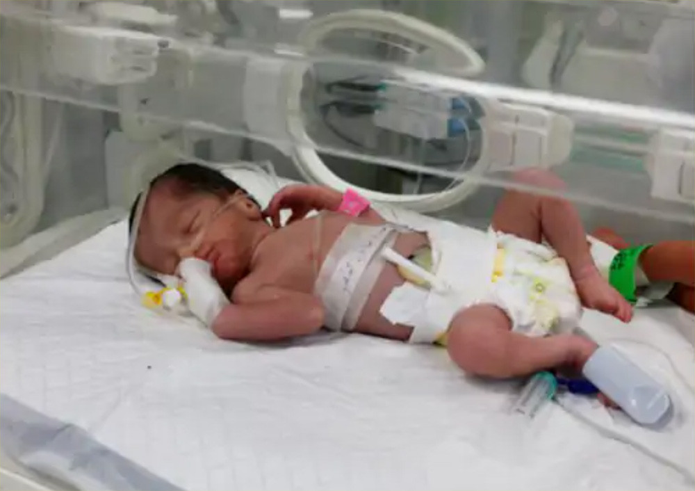 मारिएकी महिलाको गर्भबाट जीवित बच्चा निकालियो