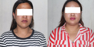 ‘हनी ट्रयाप’ : होटलमा बोलाएर नग्न फोटो खिच्दै  घर र जग्गाको डिमान्ड