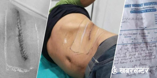 नेपाली युवालाई भारत लगेर मिर्गौला निकालिएको घटना: थप दुईजना पक्राउ