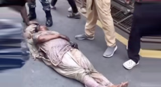 आगजनीमा परी झलनाथ पत्नी घाइते, अवस्था चिन्ताजनक