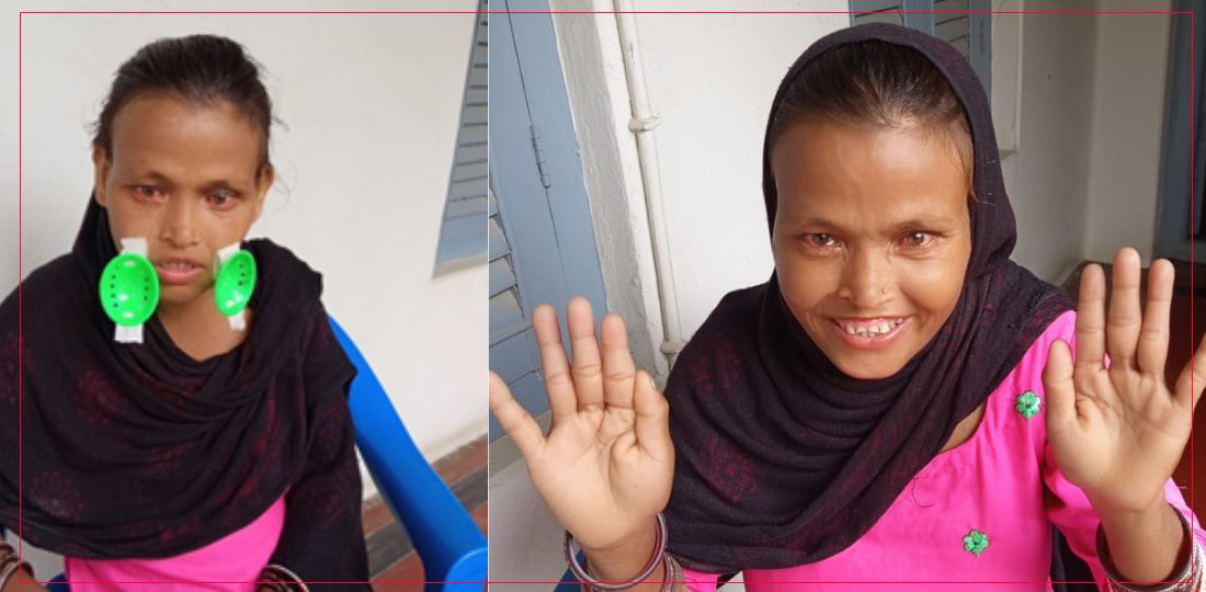 आँखाको ज्योति फर्किएपछि चन्द्रावती : ‘अब  संसारसँग छामेर होइन, हेरेर आफैँ जुध्न सक्छु’