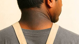 गर्धन किन कालो देखिन्छ ?