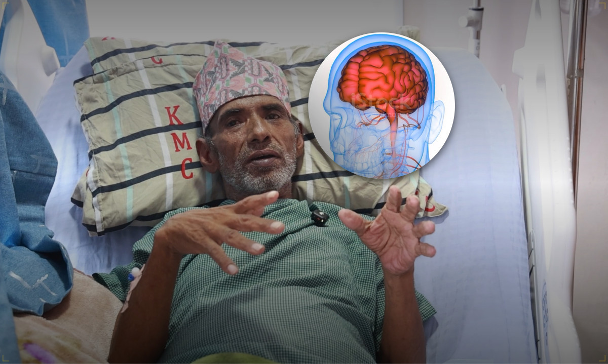 केएमसीमा ६७ वर्षीय वृद्धको मस्तिष्कको जटिल ‘एभीएम’ को विना चिरफार सफल उपचारः नेपालकै पहिलो घटना भएको दाबी